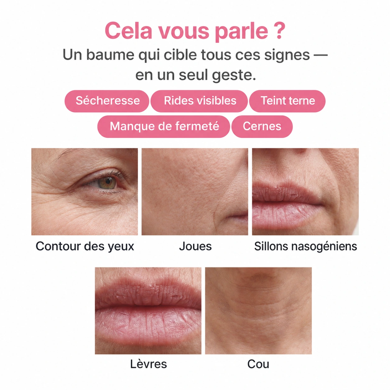 Zones ciblées : contour des yeux, joues, sillons nasogéniens, lèvres et cou.